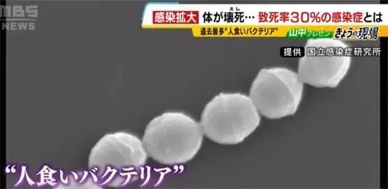 日本食人菌感染病例增加